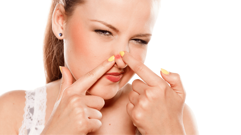 O perigo de espremer espinhas do nariz&nbsp;⚠️