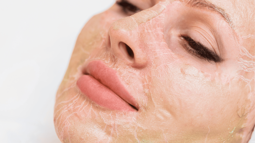 Estética Internacional: Tratamento&nbsp;Enzimático